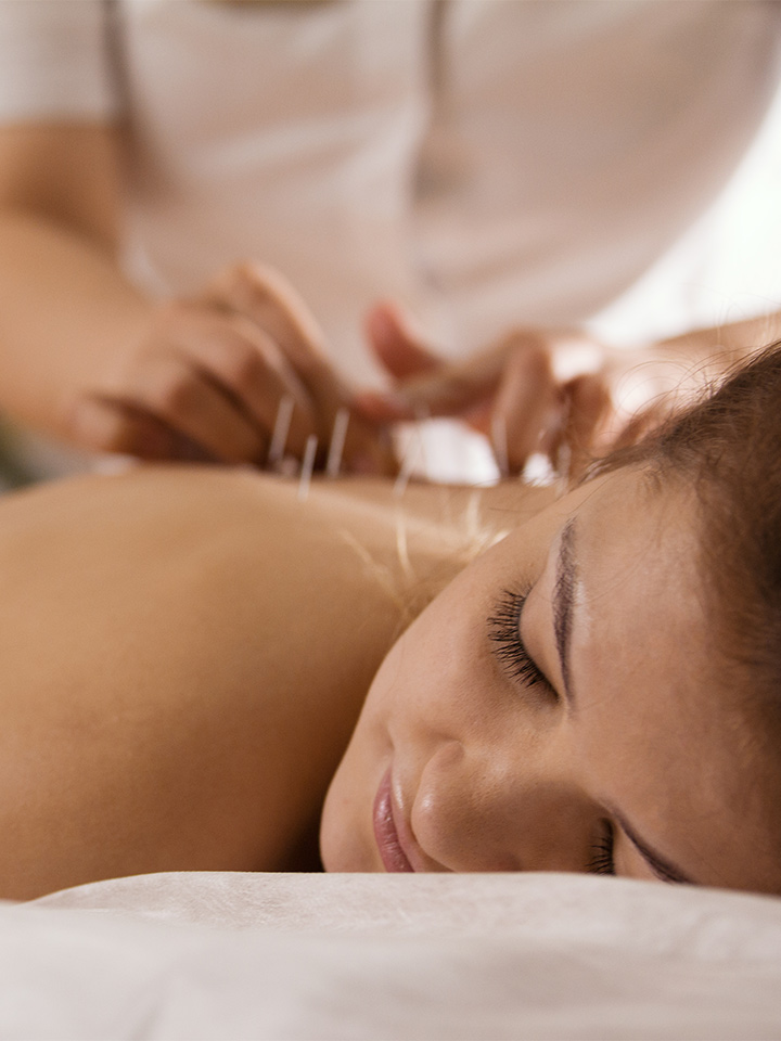 a woman enjoying an acupuncture spa session.